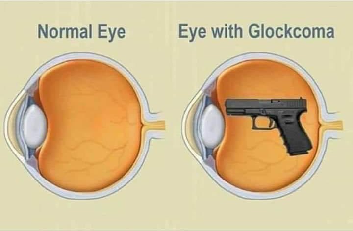 glockoma.jpg